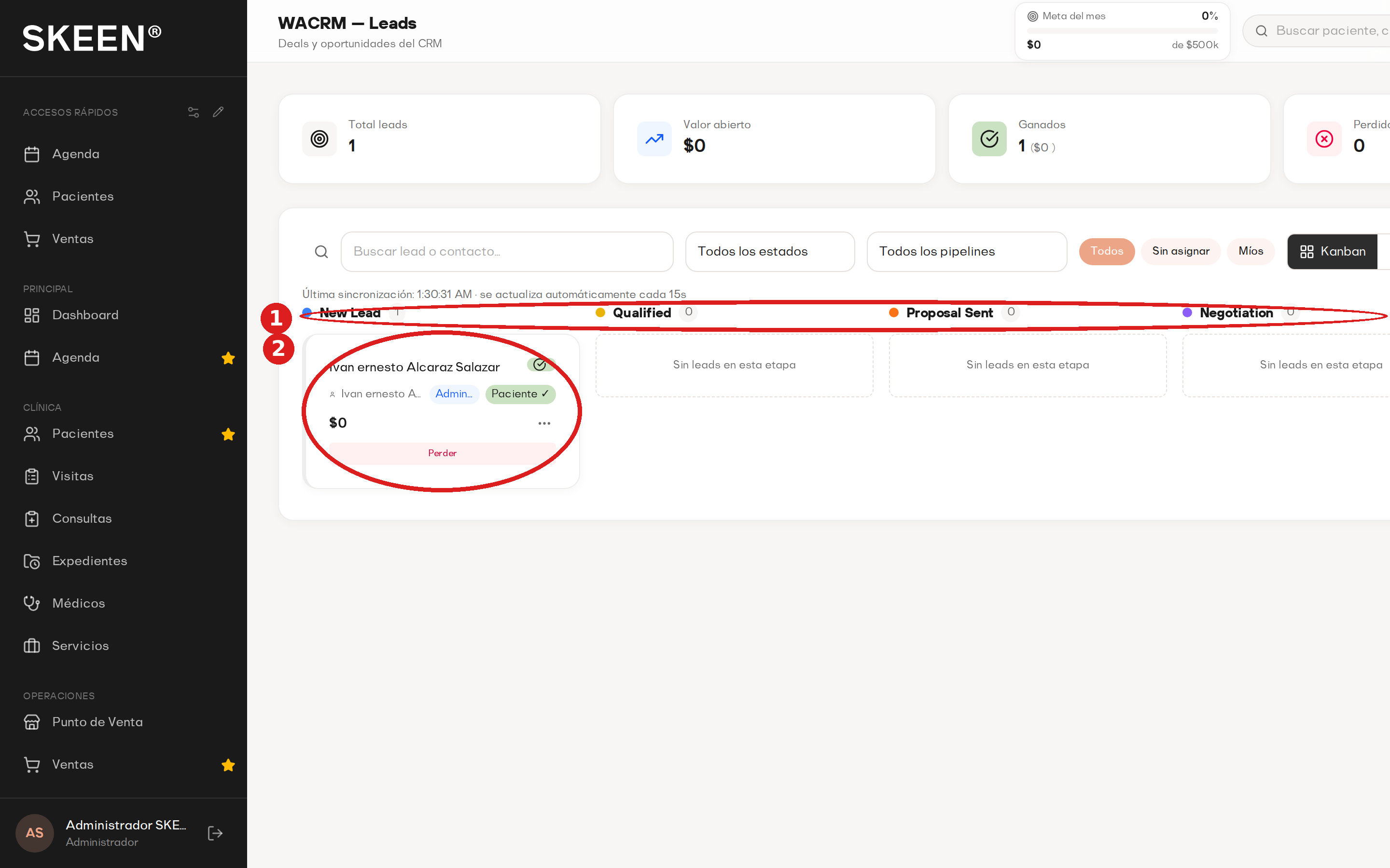 La pantalla de leads